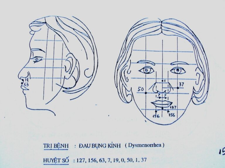 Đau Bụng Kinh